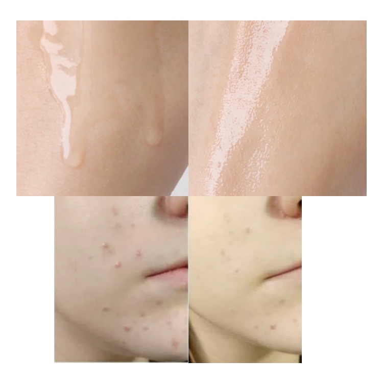 Tinh Chất Axit Lactic 10% + HA 30ml THE ORDINARY