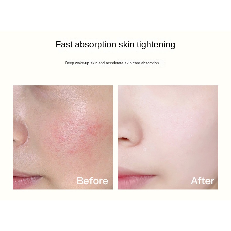 Hih Máy Mát Xa Nâng Cơ Mặt Và Săn Chắc Da Mặt Sử Dụng Sóng Siêu Âm Tạo Khuôn Mặt Chữ V