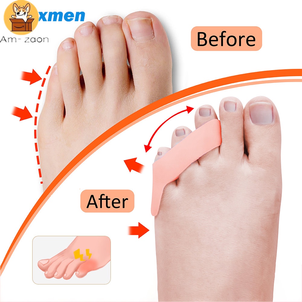 Set 2 Dụng Cụ Tách Ngón Chân Ba Lỗ Giảm Đau Hiệu Quả
