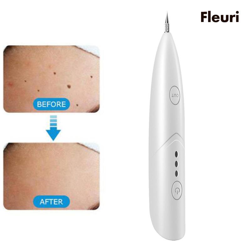 Bút Điện Loại Bỏ Tàn Nhang Và Đốm Đen Hiệu Quả