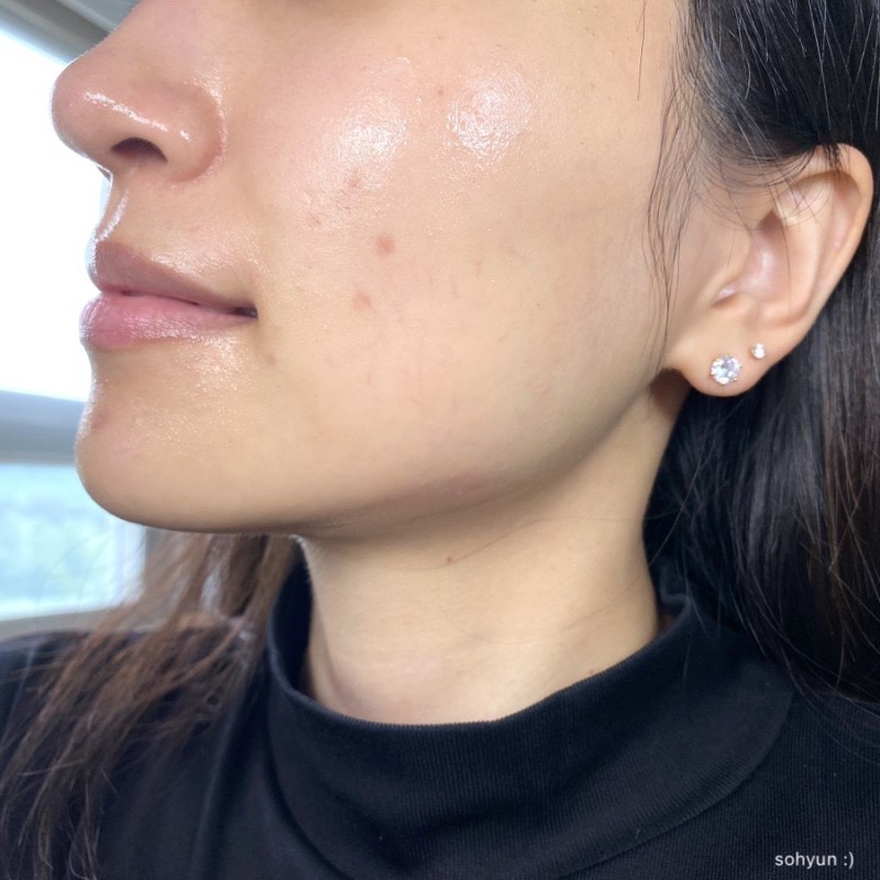 Serum giảm mụn viêm Dr.G A'Clear Spot For Face Serum