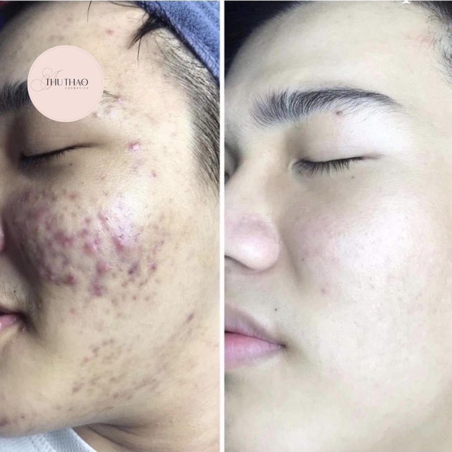 Serum Caramel Essence ThuThaoCosmetic