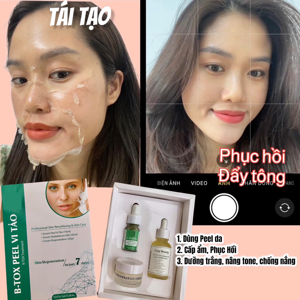 Peel Da Vi Tảo B-TOX và Chăm Sóc, Dưỡng Da Sau Peel (tái tạo da, cấp ẩm, phục hồi, dưỡng trắng có chống nắng)