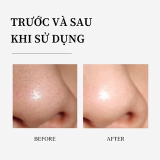 Set 3 / 8 Miếng Dán Mũi Làm Sạch Sâu Breylee