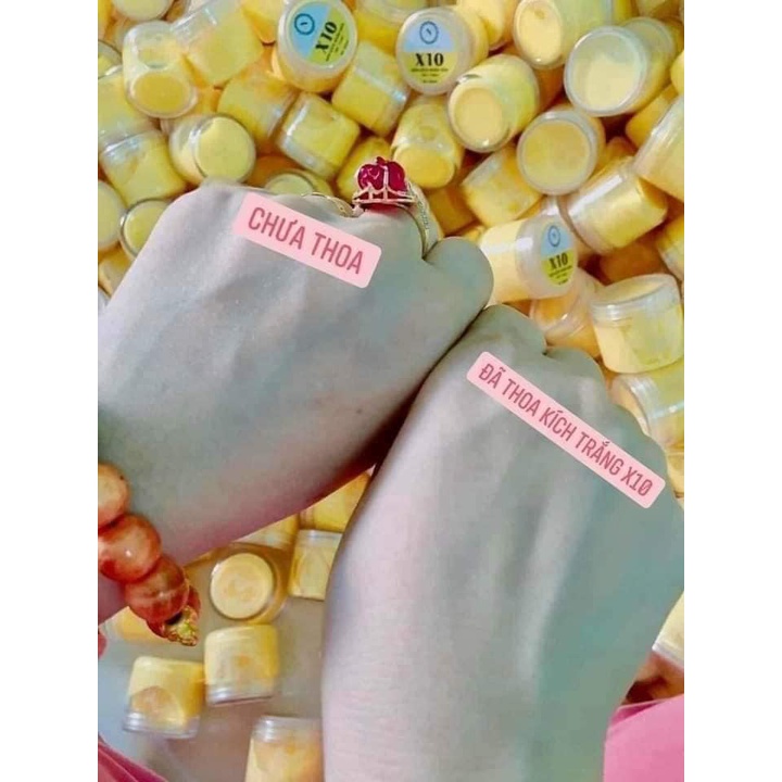 Kích trắng nhân sâm X10