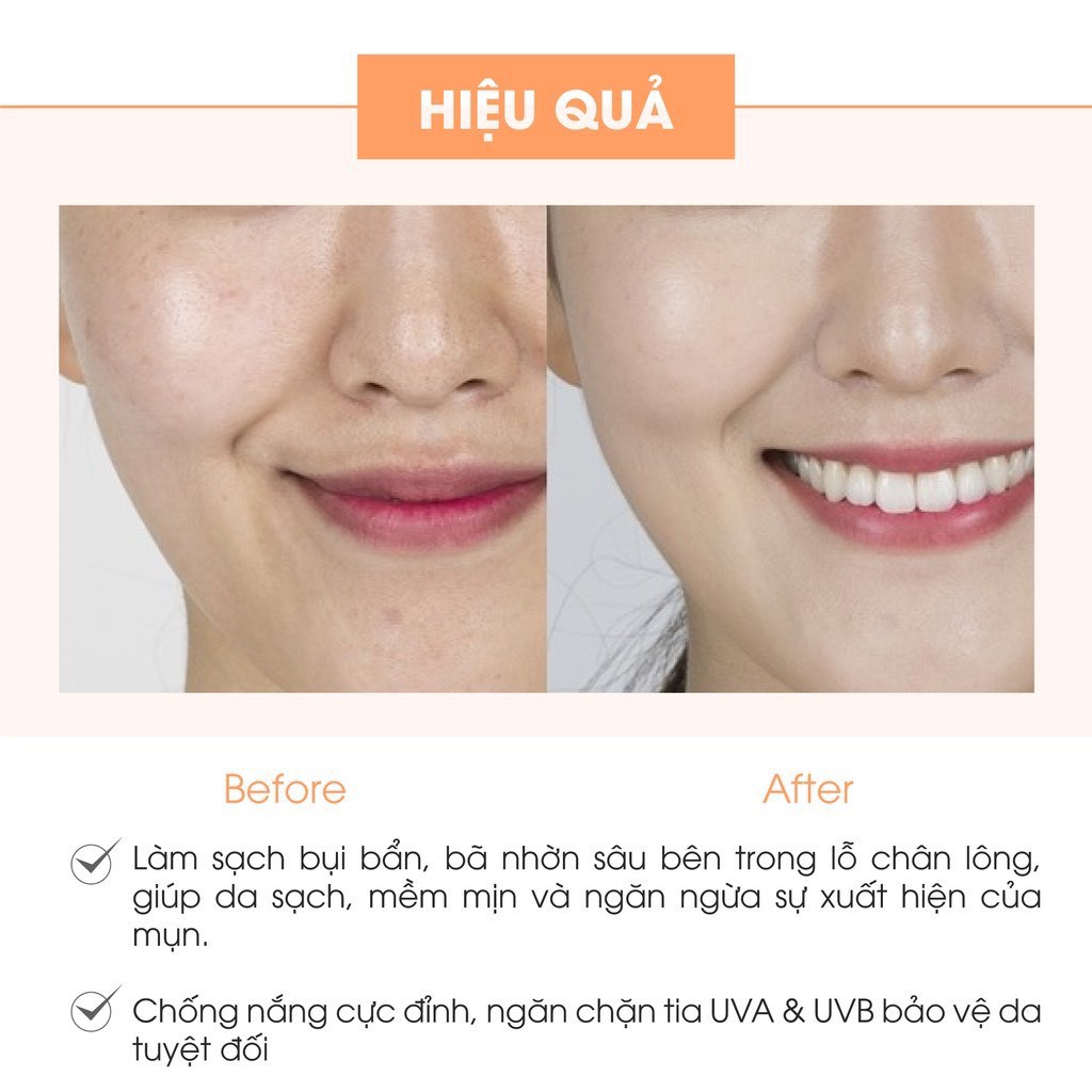 Set dưỡng trắng da mặt Acosmetics gồm kem Face Pháp và serum Spot Essence dưỡng ẩm, làm sáng và đều màu da