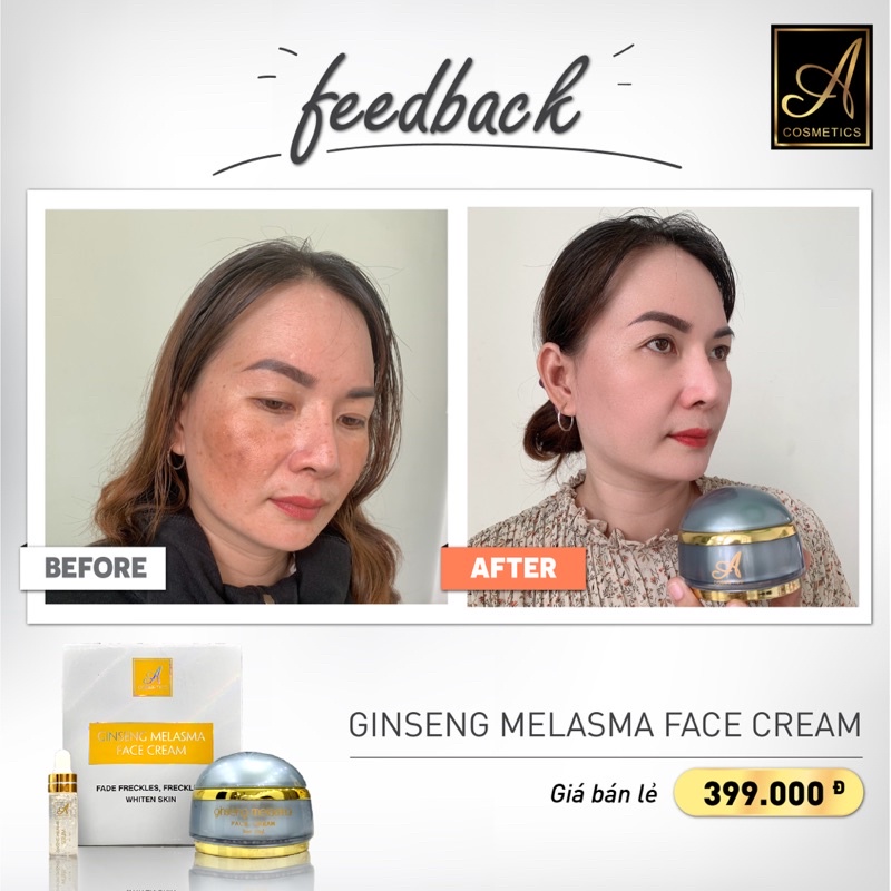 Kem Face Nám Nhân Sâm Acosmetics Phương Anh Hàng Chính Hãng