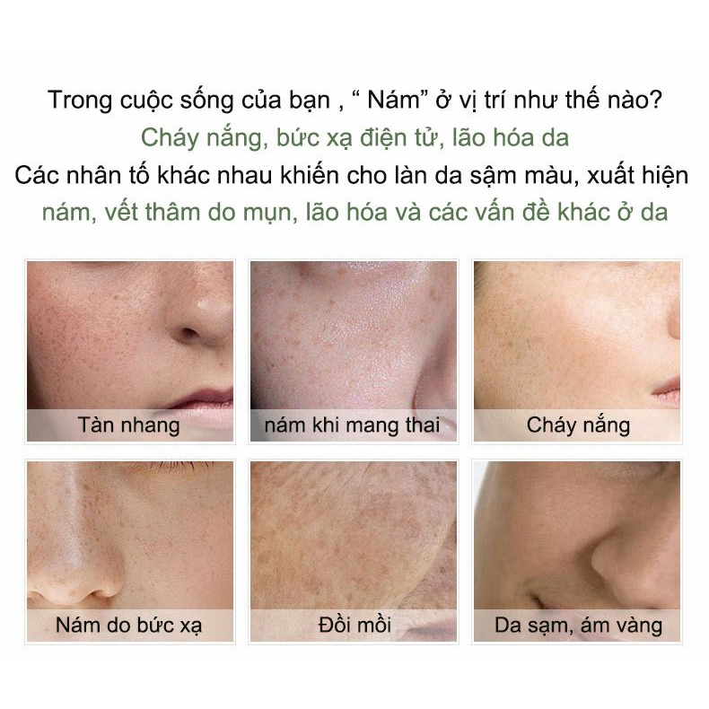 Kem nám tàn nhang kem trắng da Kem dưỡng da mặt 30g xóa vết thâm nám, tàn nhang làm mờ hắc tố, làm trắng da, săn chắc da tinh chất chất làm trắng da mặt chăm sóc