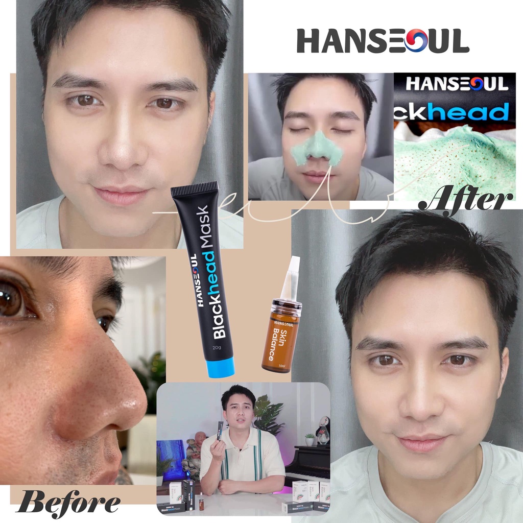 combo Gel lột mụn đầu đen Blackhead Mask - mỹ phẩm công nghệ Hàn Quốc (tặng serum se khít lỗ chân lông)