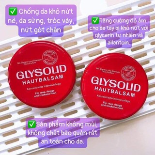Kem Nẻ Glysolid Hautbalsam 100 ml [NỘI ĐỊA ĐỨC]