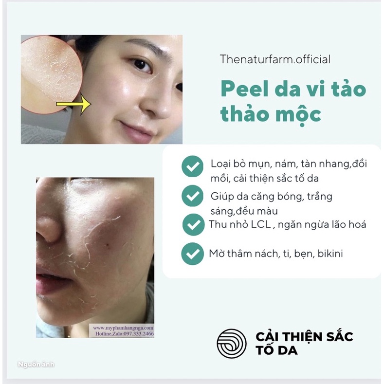 Peel da vi tảo thảo mộc naturfarm cải thiện các vấn đề về da, thay da sinh học