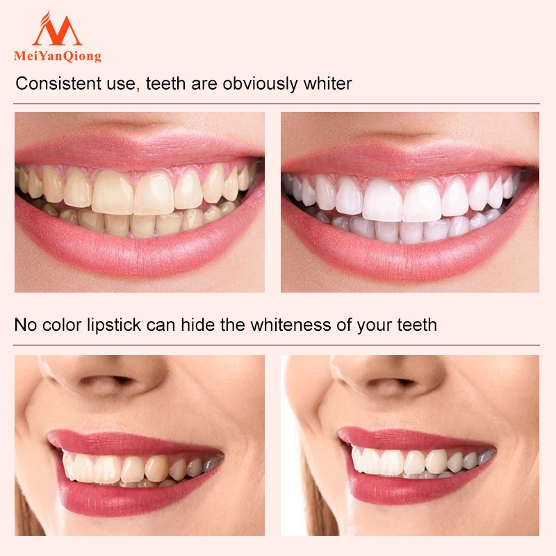 Set 5 Bút Làm Trắng Răng MeiYanQiong Loại Bỏ Các Vết Bám Mảng