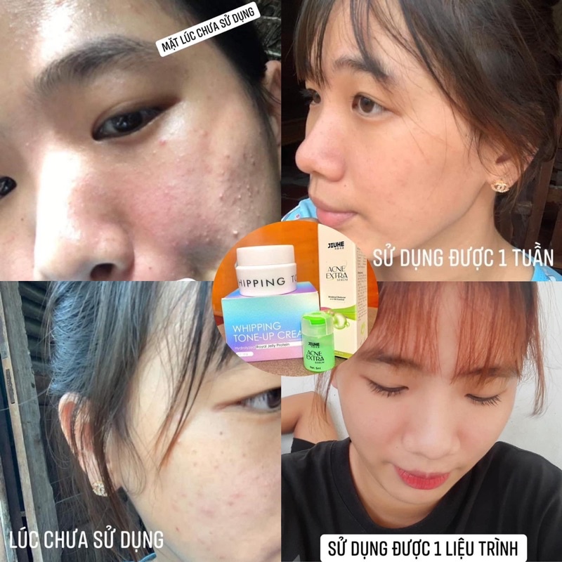 [Chính Hãng] Thanh Tô Combo Serum Thâm Nám + Kem Face