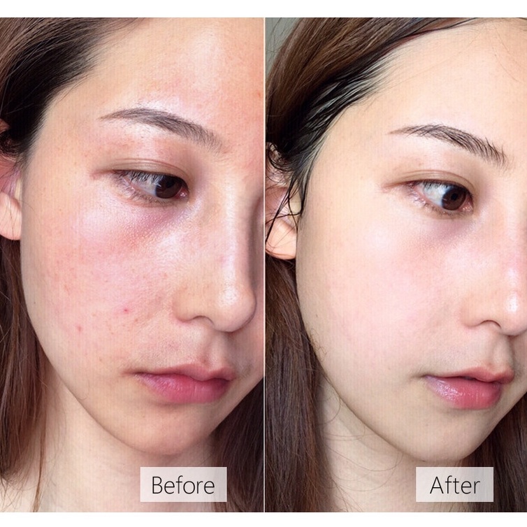 Kem dưỡng ẩm Oukeya Anti-Cracked Skin Repair Urea Cream