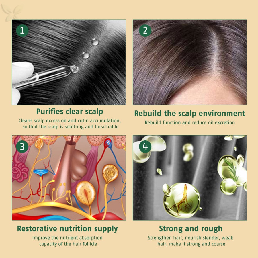 Tinh Dầu Chăm Sóc Tóc Chống Rụng Tóc jmmz