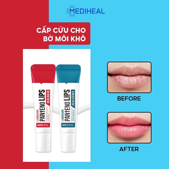 Son Dưỡng Mediheal Làm Mềm Và Hồng Môi Labocare Panteno Lips - Healssence, Son Dưỡng Môi Ngừa Thâm Panteno Lips SAIKOU