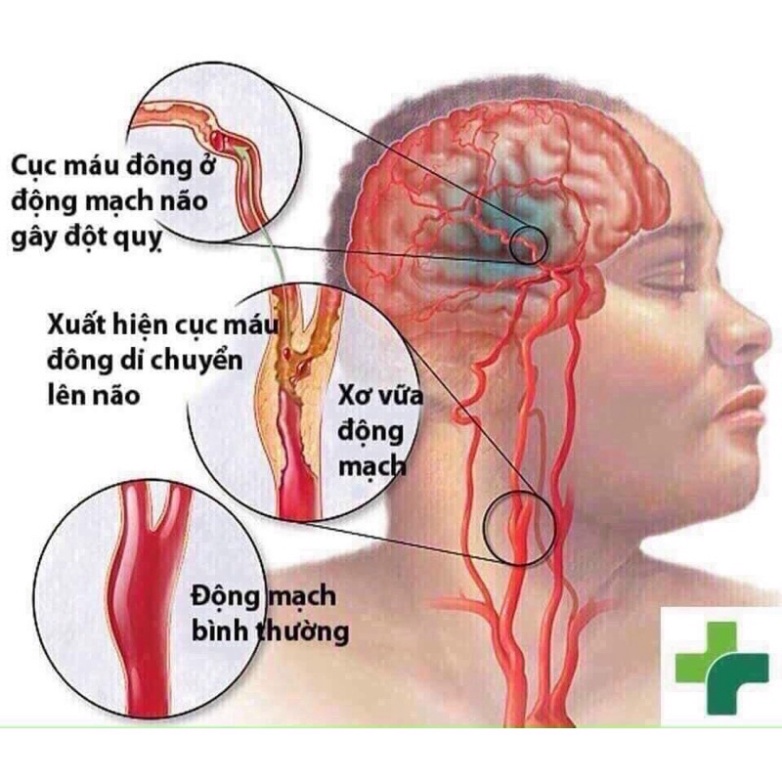 [ Kèm Bill ] An Cung Ngưu Hoàng Hoàn  Hàn Quốc, Hộp 10 Viên Mẫu Mới Nhất [ Hàng Mới Về ]