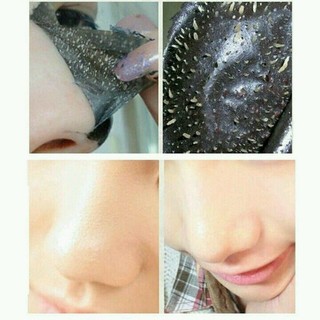 Gel lột mun CHEERY 200gr