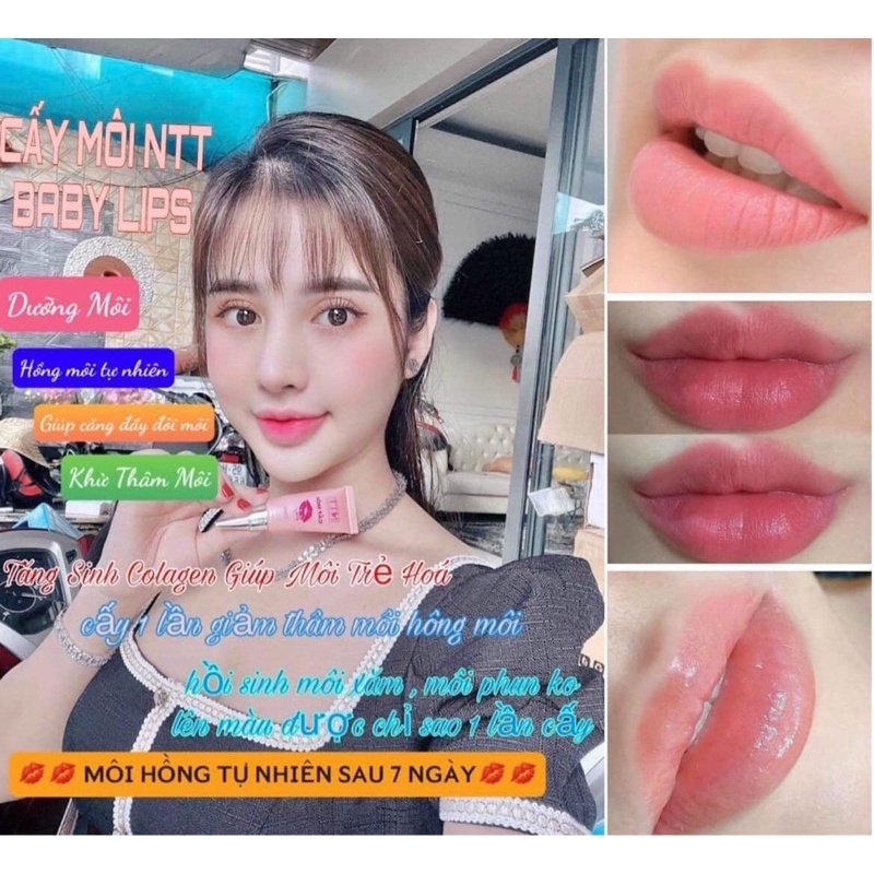 Cấy môi NTT Ngọc Trương [ Chính hãng 100%]