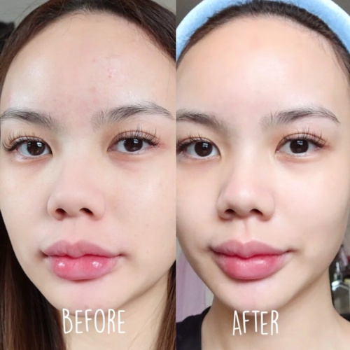 Sữa Rửa Mặt Ngăn Ngừa Mụn Garnier Skin Naturals Bright Complete Anti-Acne Cleansing Foam 100ML