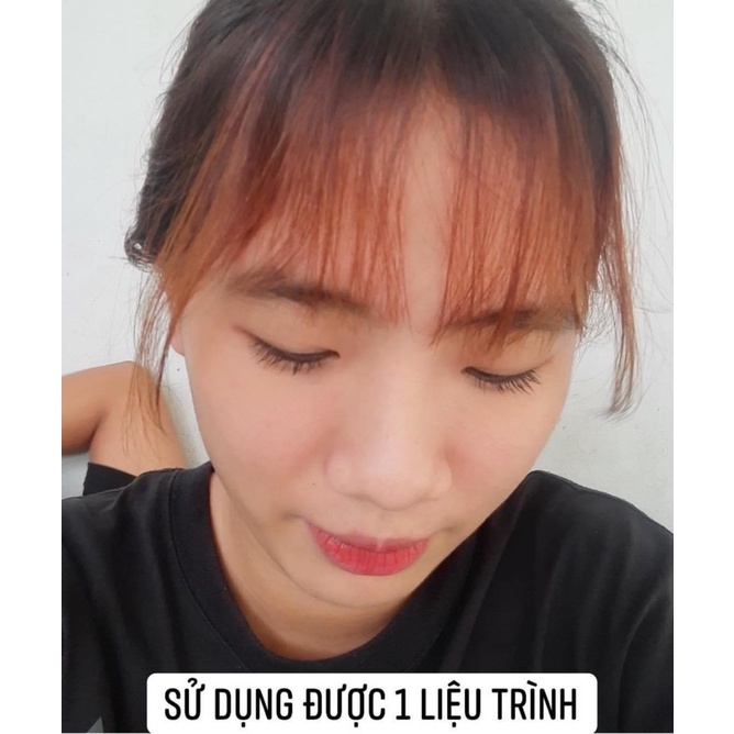 [Chính Hãng] Thanh Tô Combo Serum Thâm Nám + Kem Face