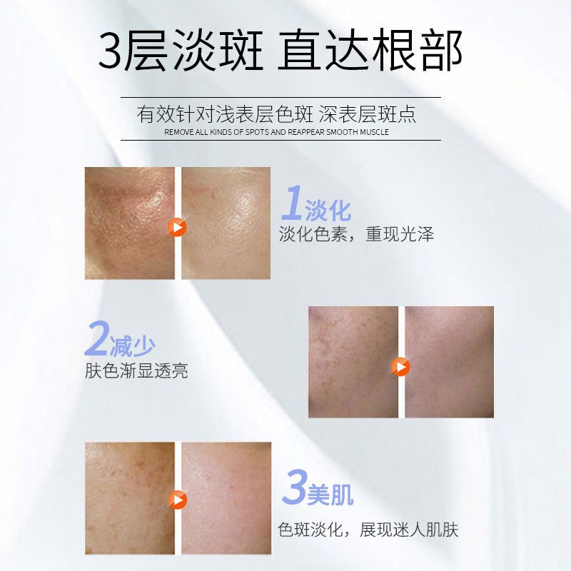 Kem Xóa Tàn Nhang Làm Trắng Da Chống Lão Hóa Và Đốm Nâu Cho Phụ Nữ Mang Thai