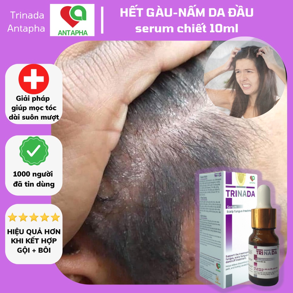 Nấm da đầu, serum sạch gàu hết ngứa loại bỏ nấm da đầu, ngăn rụng tóc hỗ trợ mọc tóc Antapha dạng chiết 10ml