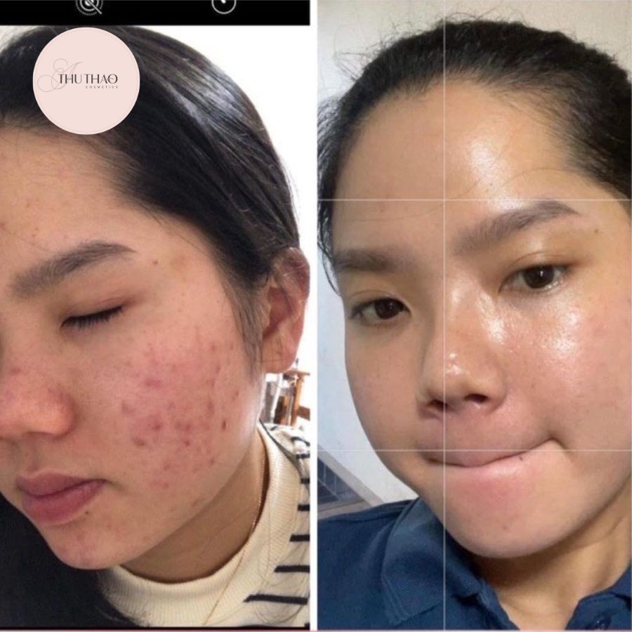 Serum Caramel Essence ThuThaoCosmetic