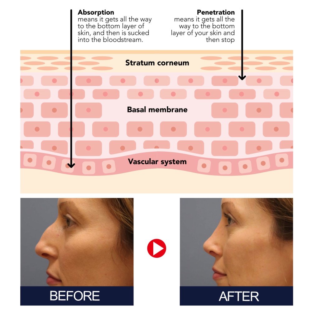 Tinh Dầu Jayswing massage Nâng Mũi Thon Gọn Cánh Mũi