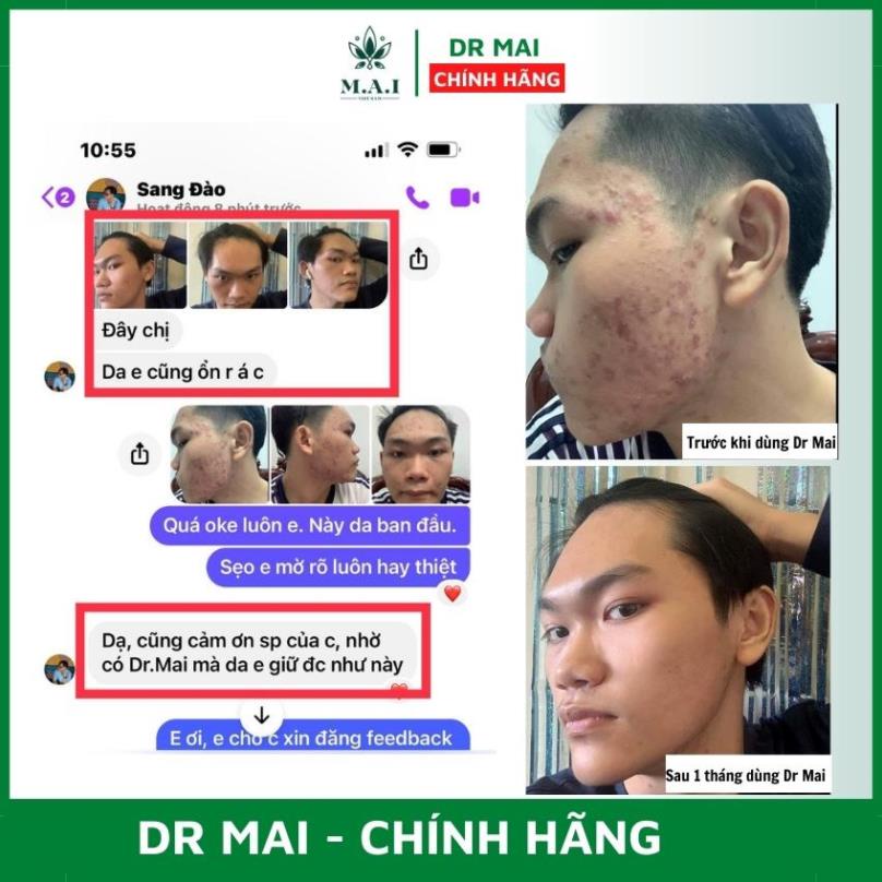 Dr Mai Combo 3 hộp serum sạch mụn dr mai nguyên chất mẫu mới 6ml lựa chọn hiệu quả cho da mụn