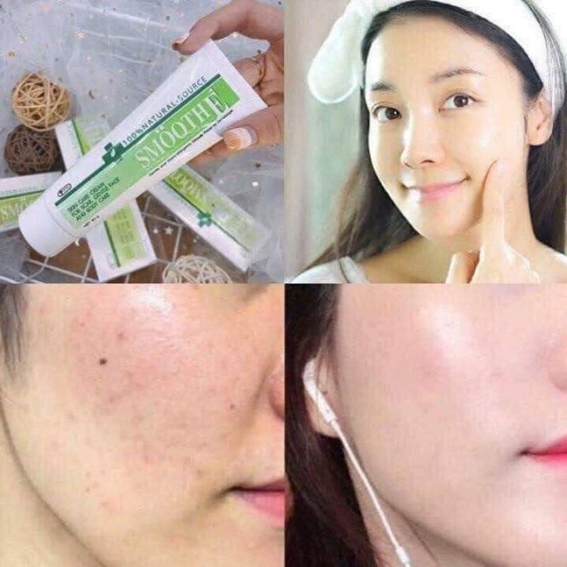 Kem Dưỡng Ẩm Mờ Thâm Sẹo Chống Rạn Da SMOOTH E Cream 15g (SmoothE)