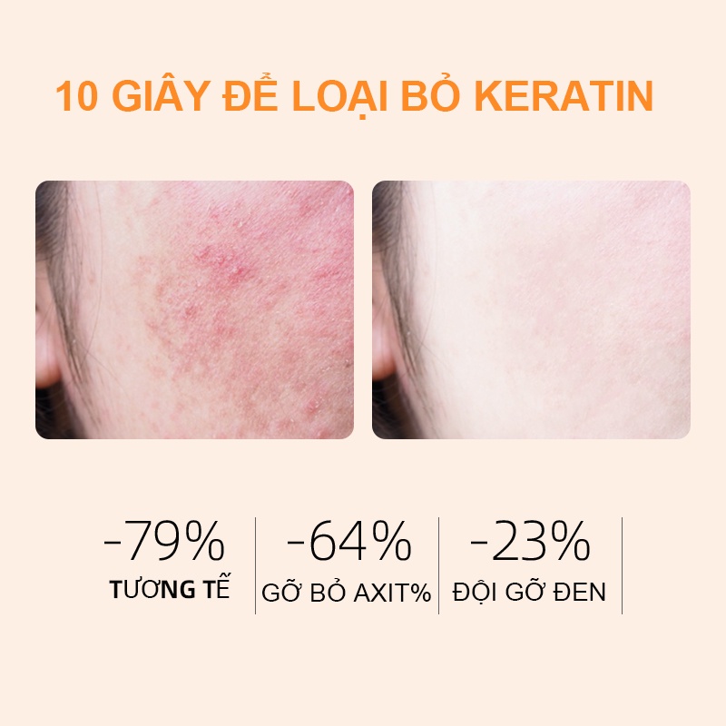 GMEELAN gel Tẩy Tế Bào Chết Orange Da Mặt Bộ bao gồm Kem Làm Trắng Da Sạch Sâu Lỗ Chân Giảm Mụn Đầu Đen 50g