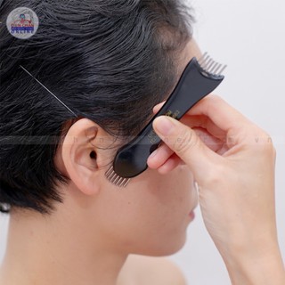 Xương cá Diện Chẩn/ Zone Detector