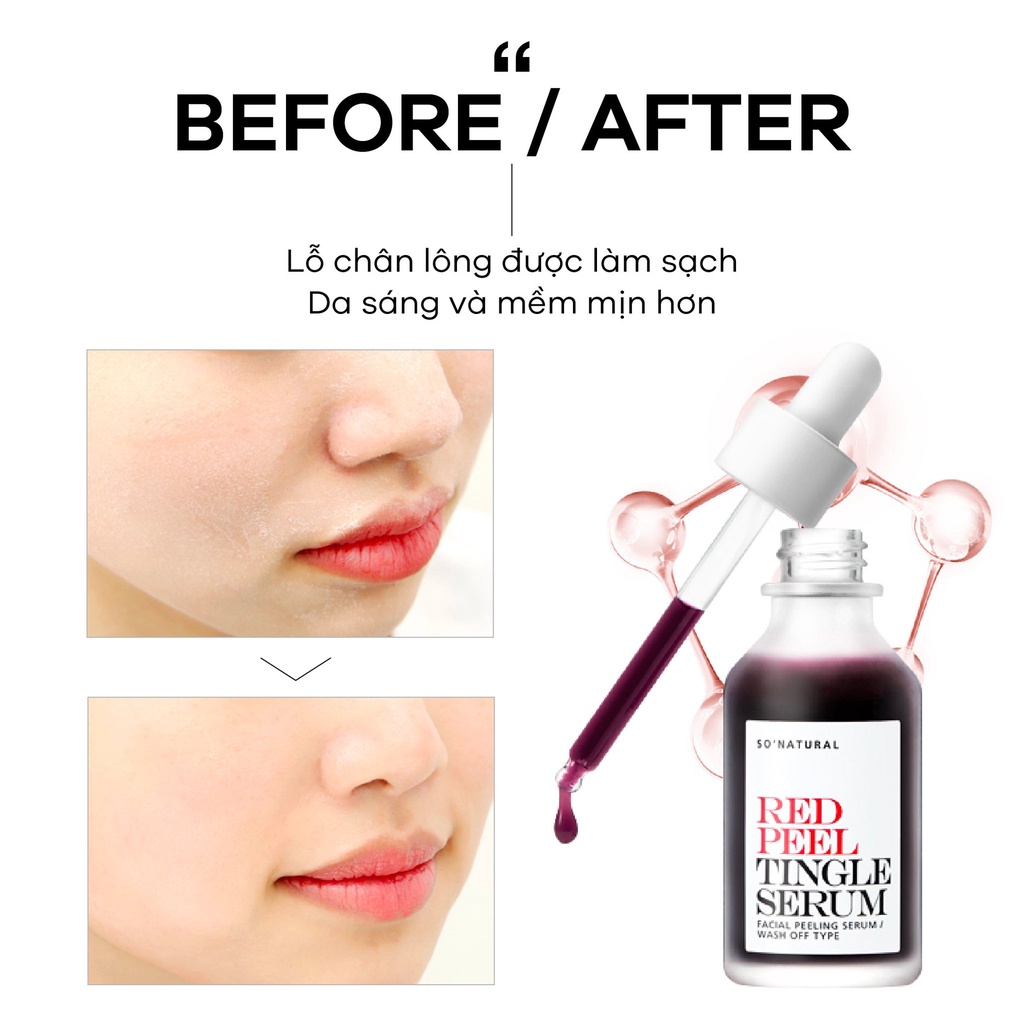 Combo 11 Tinh Chất Red Peel Tingle Serum Sample Dạng Gói So Natural (2,5ml)