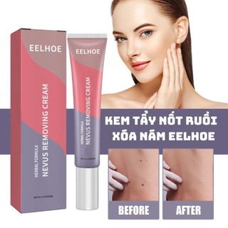 Kem tẩy nốt ruồi, xóa nám, tàn nhang, mụn thịt Eelhoe