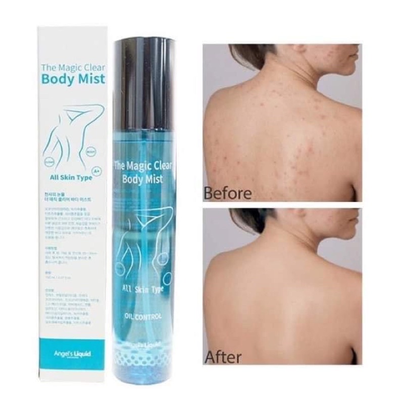 XỊT KHOÁNG VIÊN DA VIÊM LỖ CHÂN LÔNG  LƯNG THE MAGIC CLEAR BODY MIST