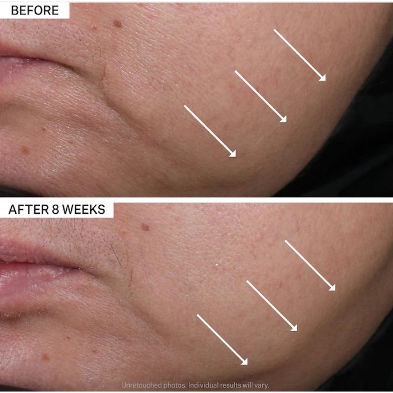 Kem săn chắc thắt chặt cơ mặt StriVectin Contour Restore Tightening & Sculpting Moisturizing Face Cream