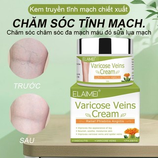  Kem bôi hỗ trợ giảm giãn tĩnh mạch ELAIMEI 50g chất lượng cao