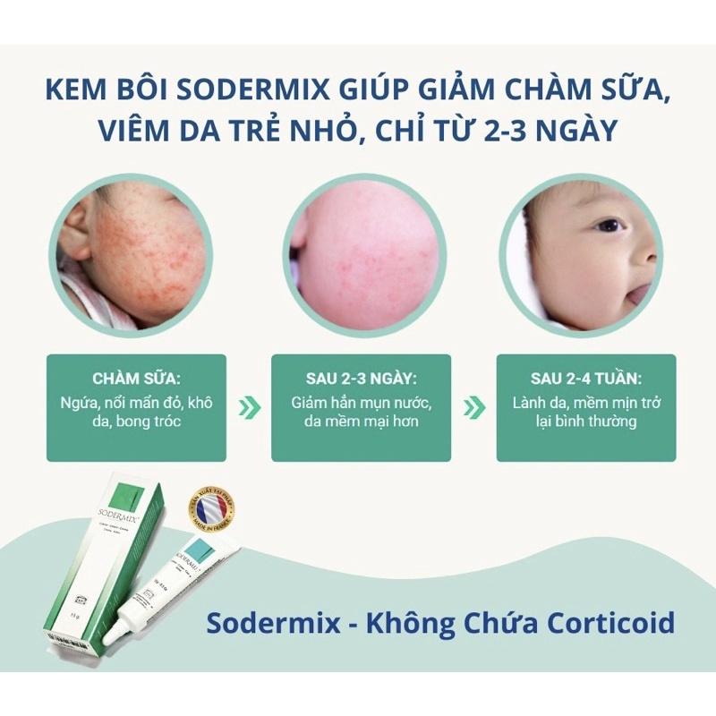 SODERMIX® Kem Bôi Chàm Sữa, Viêm Da Trẻ Nhỏ - Không Corticoid - Nhập Khẩu Nguyên Hộp Từ Pháp - Hàng Chính Hãng
