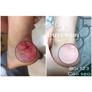 Dưỡng da 123 Bách Y Sâm