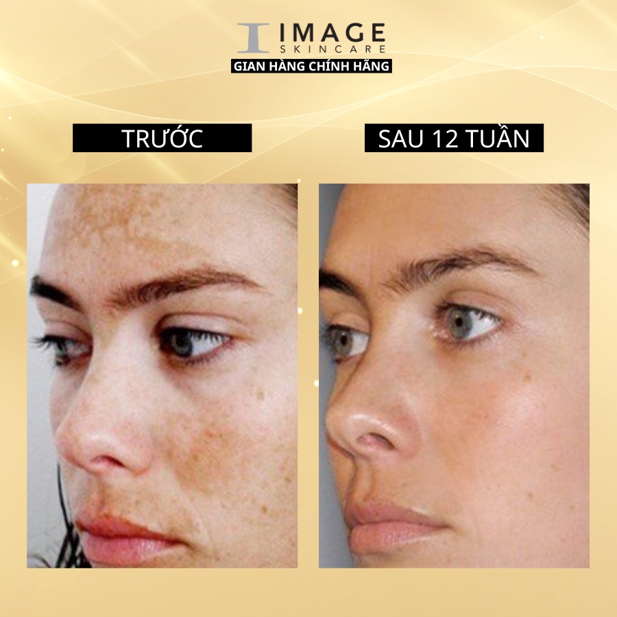 Tinh chất trẻ hóa da và mờ sẹo thâm Image Skincare MD Restoring Retinol Booster 30ml