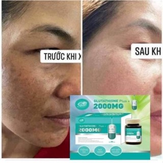 Viên uống trắng da collagen - glutathione 2000 - trắng da,mờ nám,giảm nhăn. - ảnh sản phẩm 4