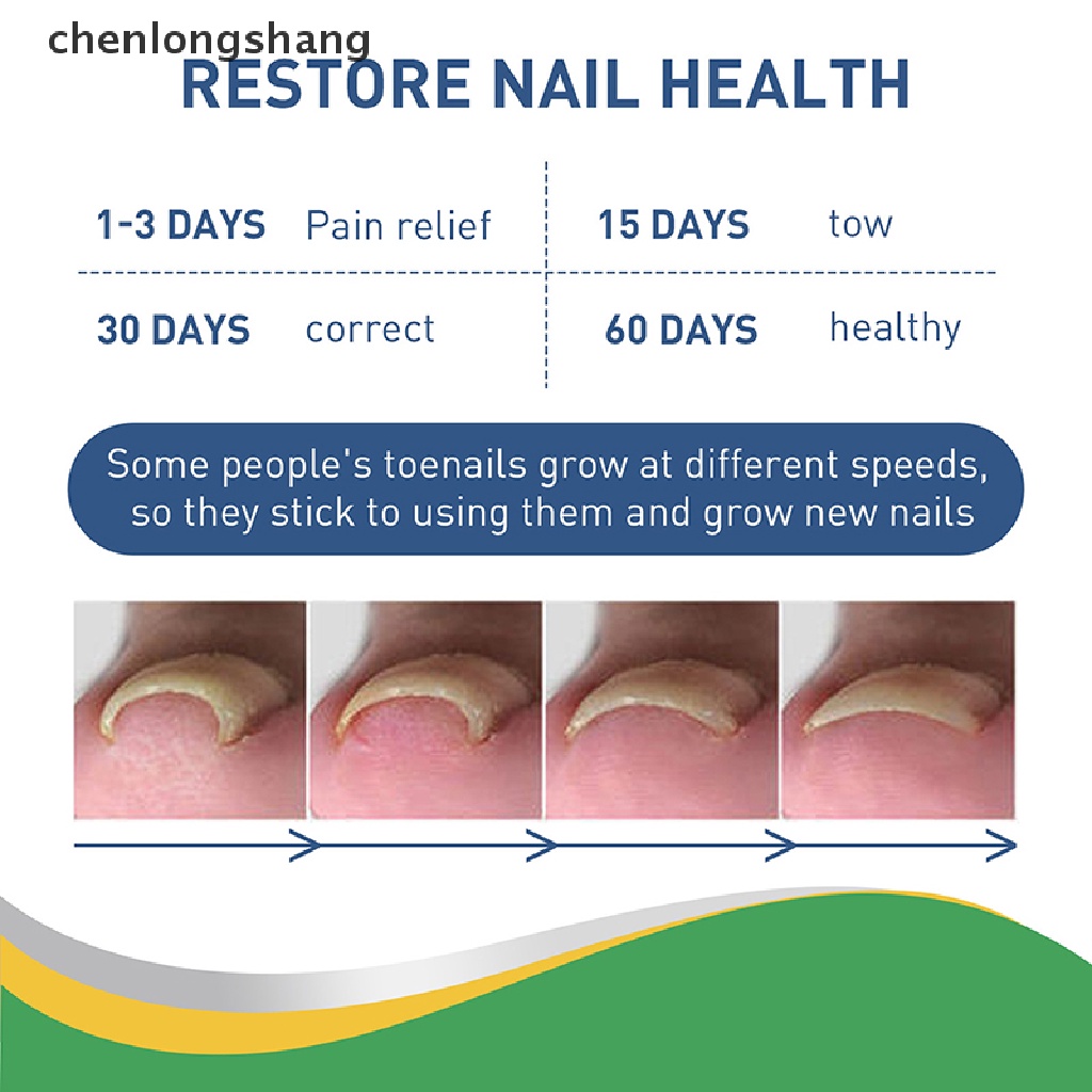 50 Miếng Dán Chỉnh Sửa Móng Chân chenlongshang