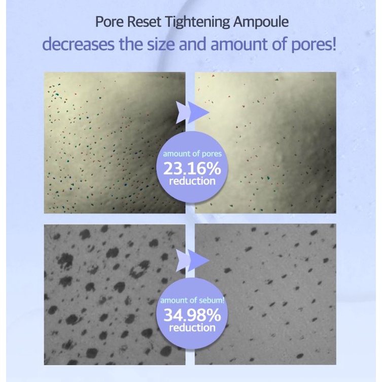 Mặt Nạ Bùn Se Khít Lỗ Chân Lông Làm Săn Chắc Da