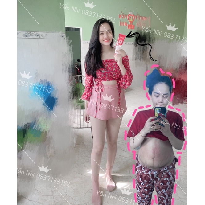 Kem tan mỡ