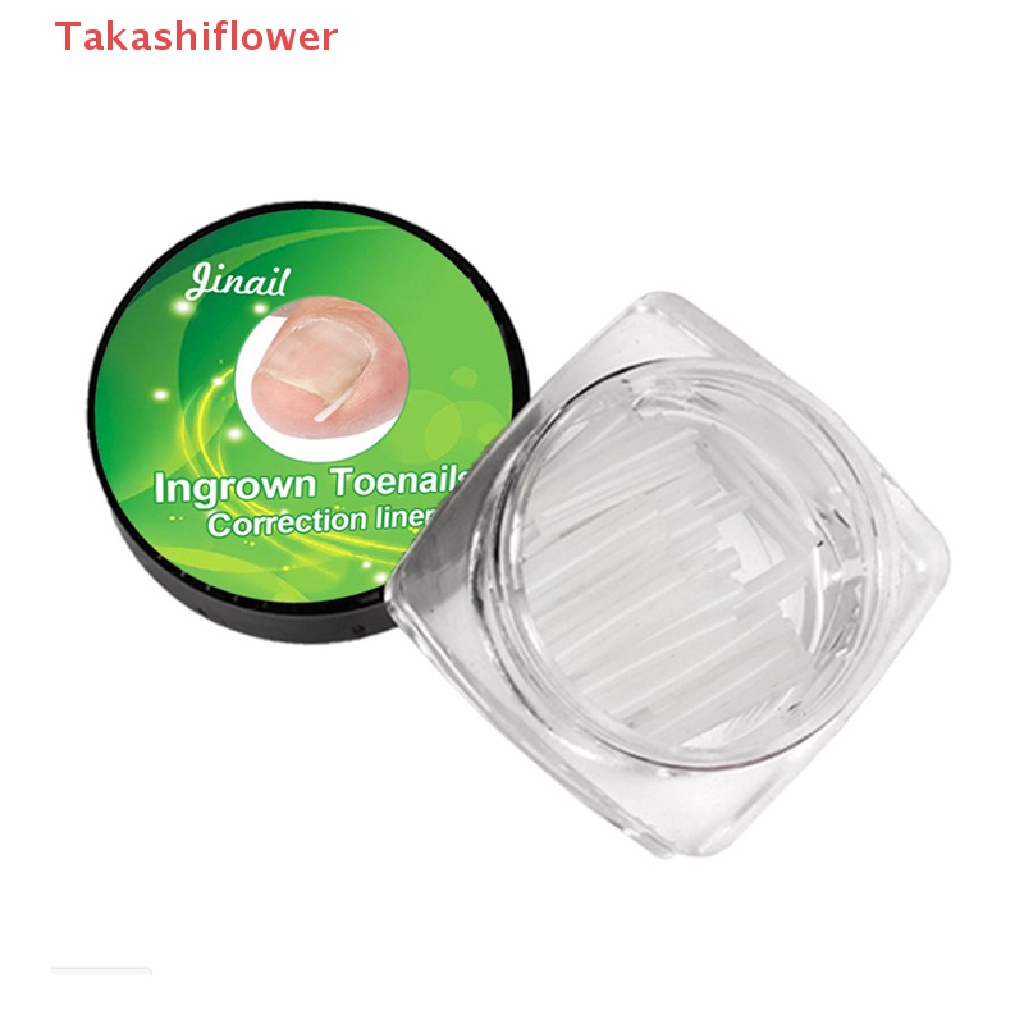 Set 10 Miếng Đệm Chỉnh Hình Móng Chân Chuyên Dụng