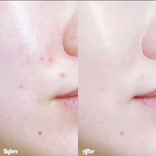 Cushion lâu trôi MOONSHOT PERFORMANCE CUSHION LIGHT FIXING SPF43 PA++