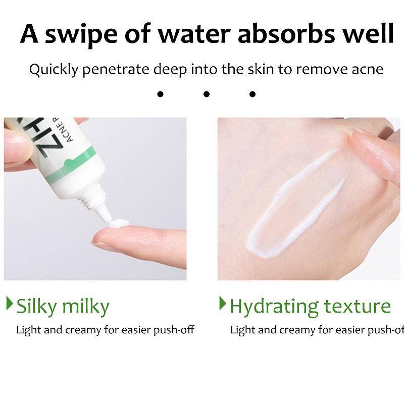 Kem Axit Salicylic Hỗ Trợ Giảm Mụn Đầu Đen Kiềm Dầu Làm Trắng Da 20g