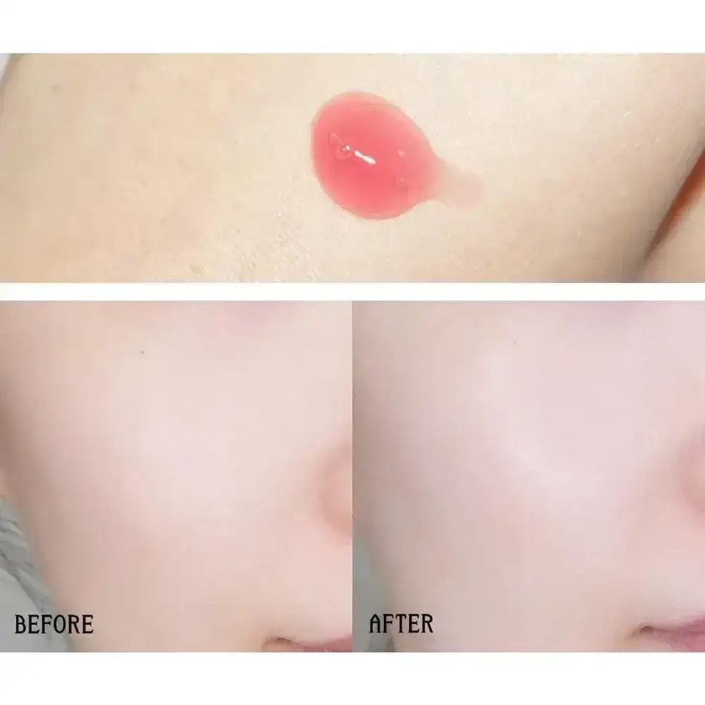 Tinh Chất Chống Lão Hóa Làm Sáng Da AHC 365 Red Serum