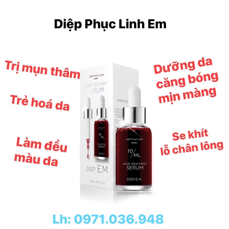 Diệp phục linh Em 10ml